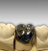 Full Titanium Crown