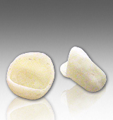 Zirconia Coping